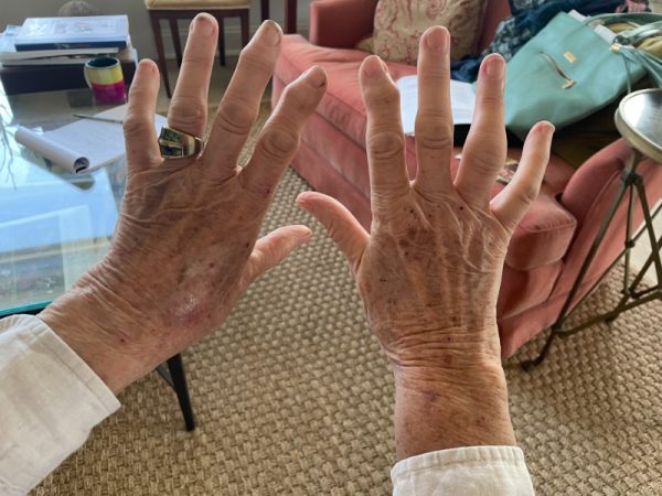 Jane MacLeish: A gardener's hands. Knollwood, 03/03/2025